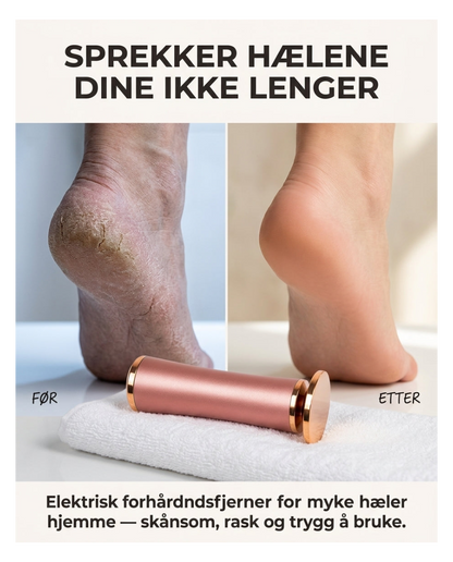 Elektrisk hardhudssliper for føtter – myke føtter hjemme
